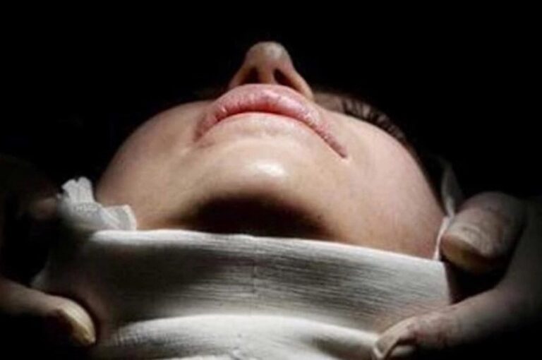 Mujer China se ‘Cambia la Cara’ Para Evadir Deuda Millonaria