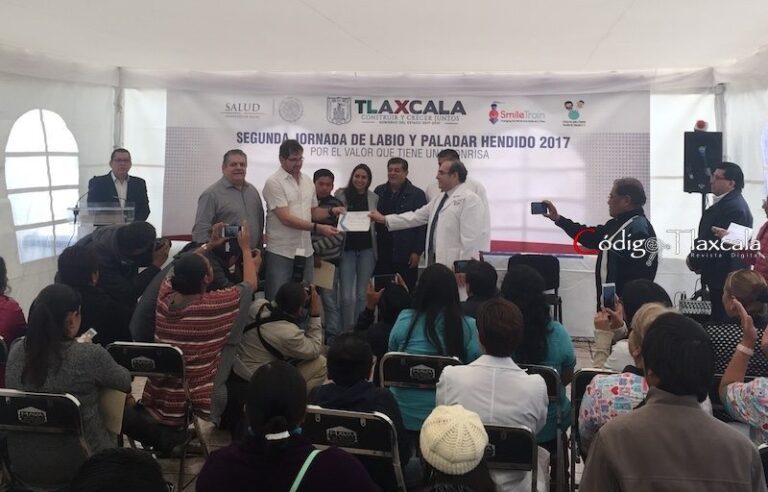 Inicia Segunda Jornada de Labio y Paladar Hendido