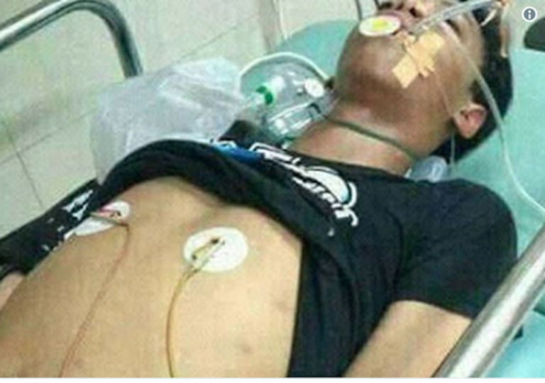 Un Adolescente Muere Tras ser Picado por su Mascota Cobra