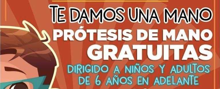 Dif Municipal Apoyará a la Comunidad con Prótesis de Mano Gratuitas