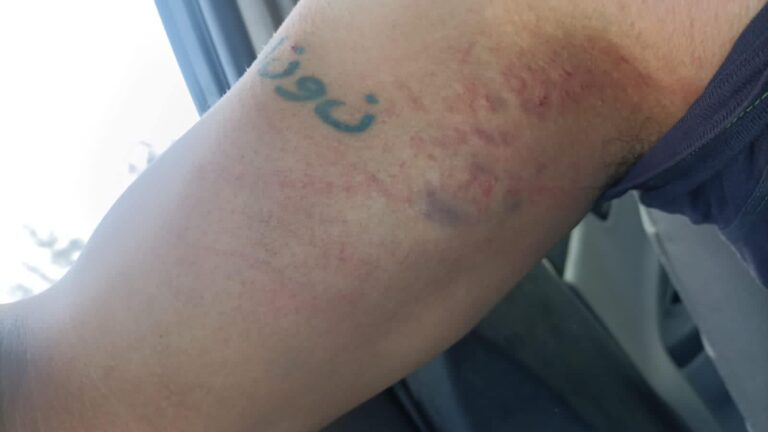 Condena UPET Agresión Contra dos Reporteros Ocurrida en Xaloztoc