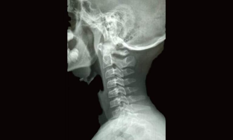 Maestro de secundaria estranguló a su alumno por salpicarlo con agua