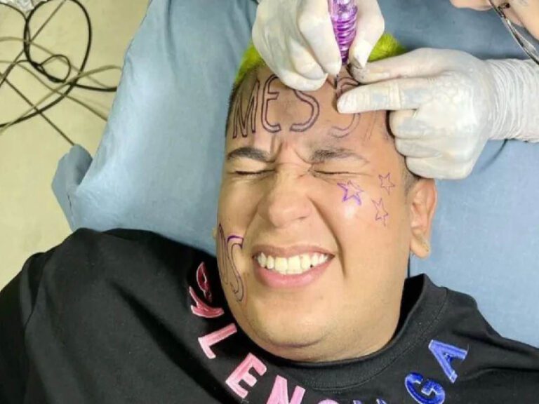 Influencer que se tatuó ‘Messi’ en la cara se arrepiente