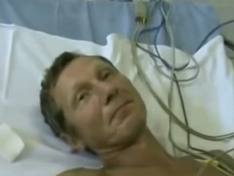 Así se ve la rabia en humanos, el avance de una letal enfermedad