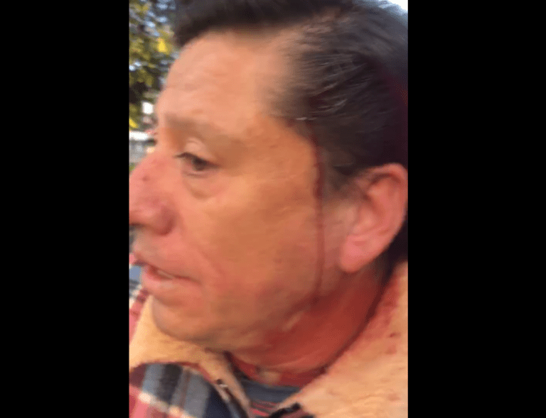 Represión en Zacatelco con Saldo de una Decena de Heridos