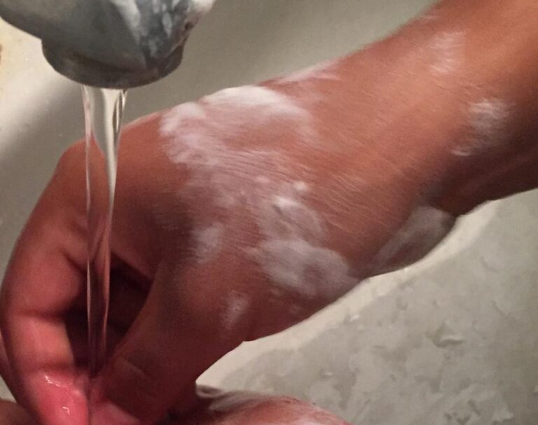 Correcto lavado de manos reduce hasta 50% enfermedades diarreicas en temporada de calor